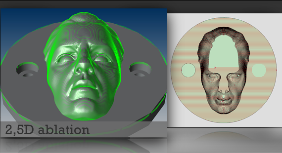 3D ablation